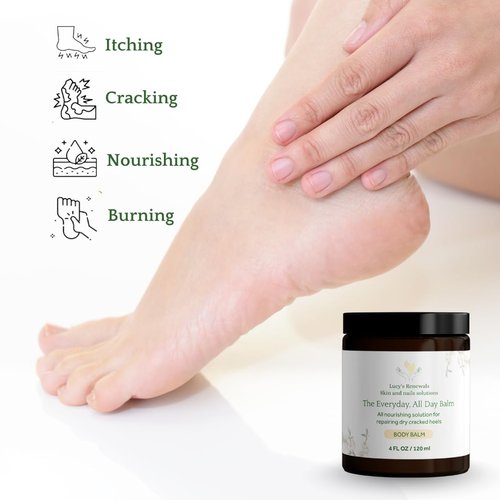 The Everyday, All Day Balm – Intense Moisturizer for Cracked Heels, Dry Skin & Body Care | Natural Shea Butter, Tea Tree & Coconut Oil | Paraben-Free (4 FL OZ)