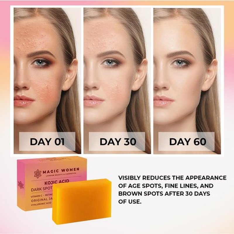 MAGIC WOMEN Kojic Acid Soap Dark Spot Remover – 2 Bar (3.5 oz Each) with Vitamin C, Retinol, Turmeric, Natural Skin Brightening