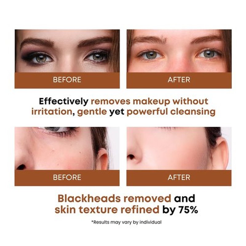 Skiennix Rice Water Cleansing Pads - Exfoliating Makeup Remover & Toner with Centella Asiatica | 50 Pads