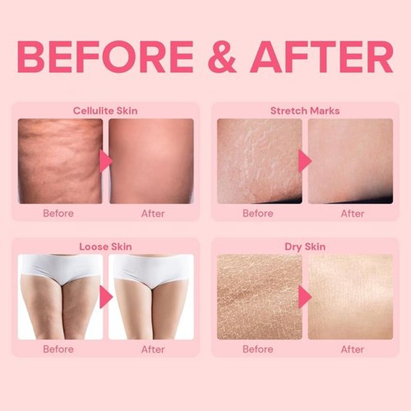 Anti Cellulite Body Firming Cream: Cellulite Remover for Legs