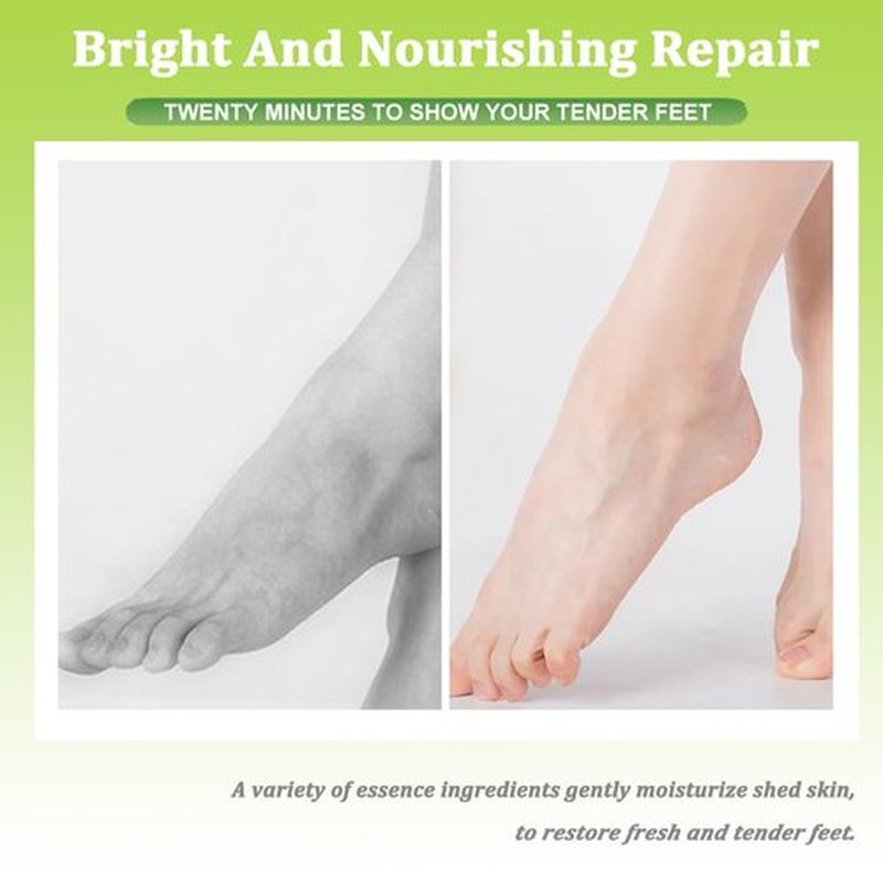 TEEROVA Repairing Foot Mask with Shea Butter and Avocado, Moisturizing Foot Mask for Dry Cracked Feet, Hydrating Foot Spa Socks (5 Pairs)