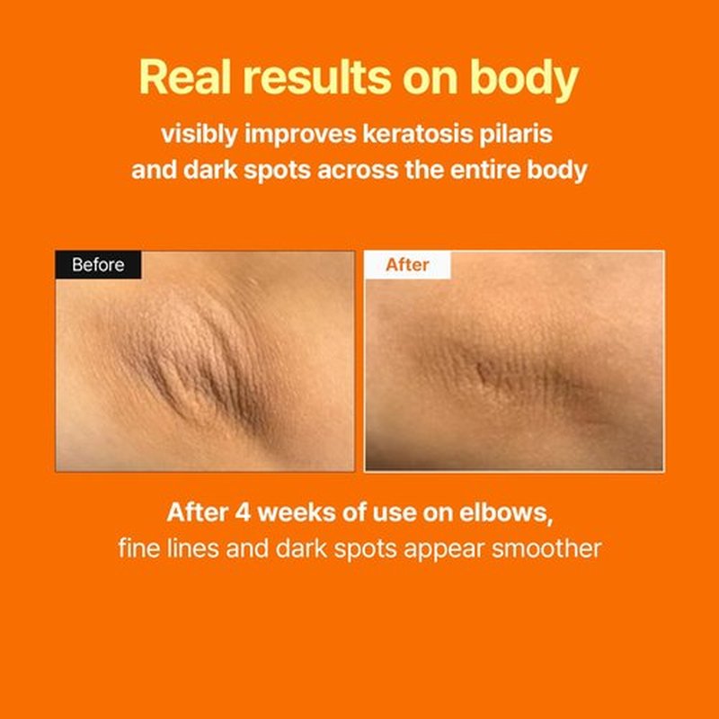 MEDITHERAPY Retinal Skin Booster Serum | Retinaldehyde, Niacinamide Anti-Aging Serum - K-Beauty Facial Serum for Fine Lines, Firming & Radiance | Hydrating Face Serum All Skin Types, 5.07 fl oz
