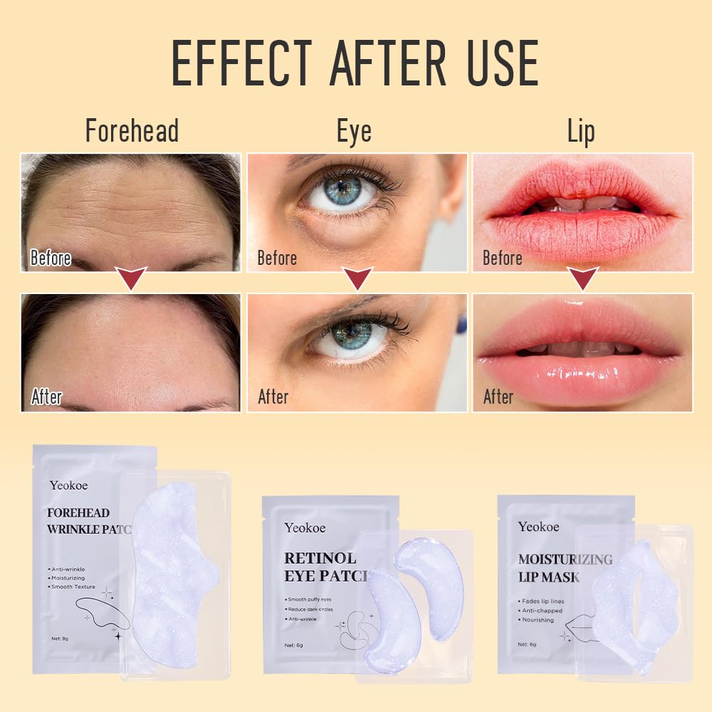 Yeokoe Forehead Wrinkle Patches,Under Eye Patches and Lip Mask 30 PCS. Face Masks Skincare With Retinol Serum For Anti-aging Puffy Eyes and Dark Circles