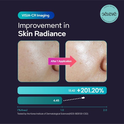 SELEVE Glow Caviar Cream – Hydrating & Glow Face Cream with Green Caviar Liposomal PDRN, Niacinamide, Ferulic Acid – For Sensitive & Dry Skin, Korean Skin Care (1.69 fl.oz / 50ml)