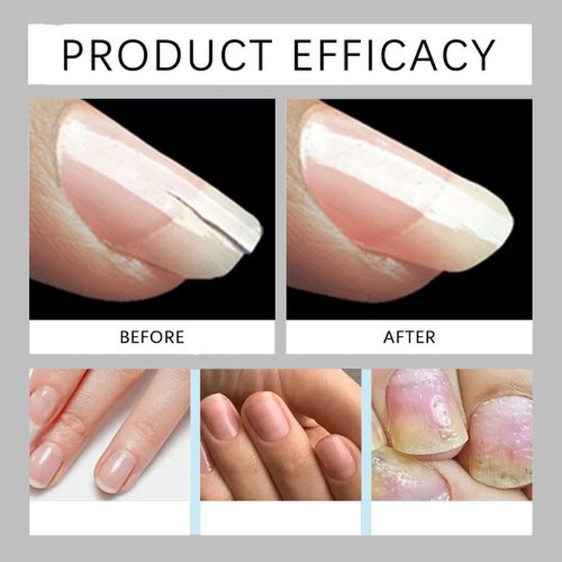 Nail Growth Pen, Stem Cell Nail Growth Pen, Radiant Nail Care, Rejuvenation Nail Repair Pen, With Lemon Tea Tree Cuticle Oil, Moisturizes And Strengthens
