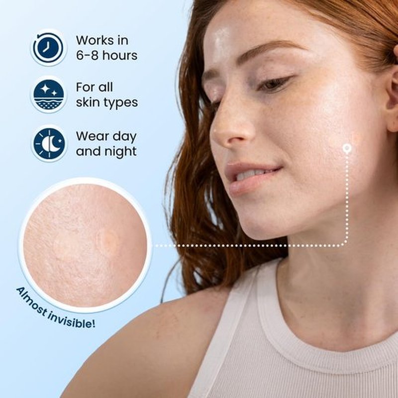 CLEAN SKIN CLUB 60 Invisible Vegan Pimple Patches, Derma Dot Hydrocolloid for Covering Zits, Blackhead, Blemish, Absorbing Face Cover Sticker, Skincare Treatment, Non Toxic Ingredients