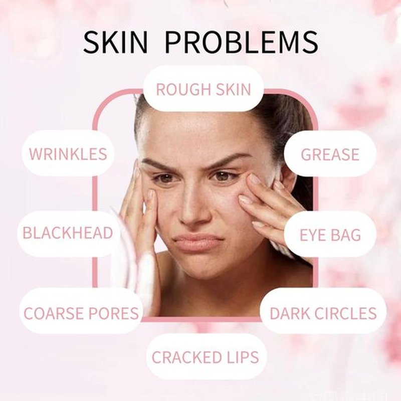 Japan Sakura Skin Care Set for Teen Girls - Evolvique Skin Care for Teens 10-12 - Skincare for Girls 10-12 - Skin Care Kit Gift Set for Women with Cleanser,Serum,Cream(One Size, 8PCS Sakura Scent)