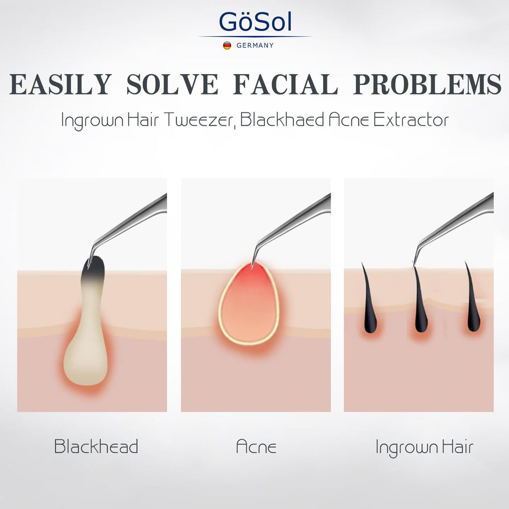 GöSol Pro Blackhead Tweezers, Precision Slant Tip for Blackhead Extraction