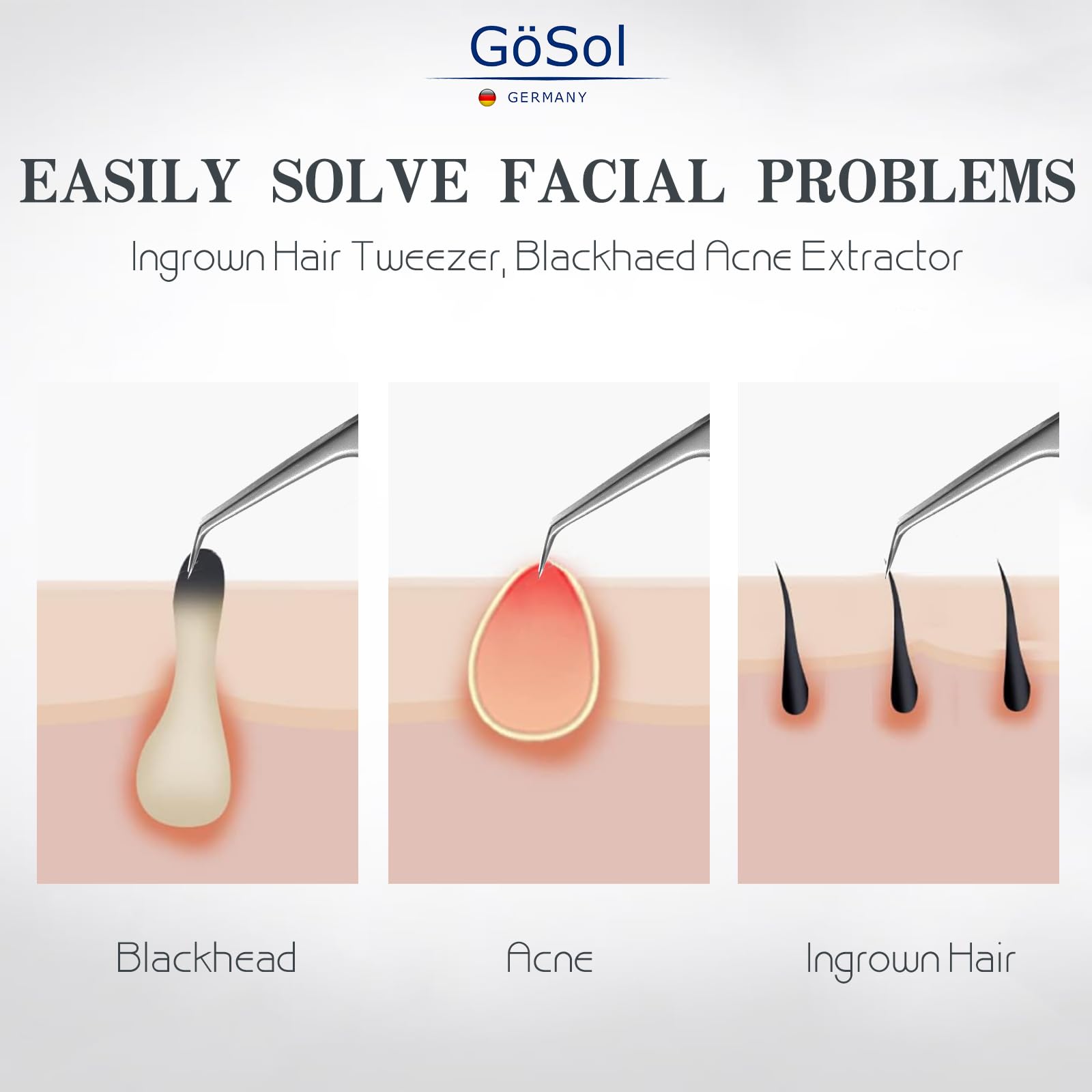 GöSol Pro Blackhead Tweezers, Precision Slant Tip for Blackhead Extraction