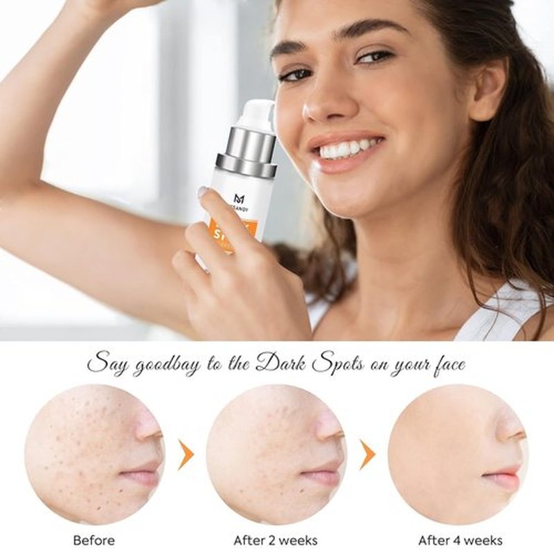 Skiennix Dark Spot Remover - 5% Niacinamide & Hyaluronic Acid Fade Cream for All Skin Types