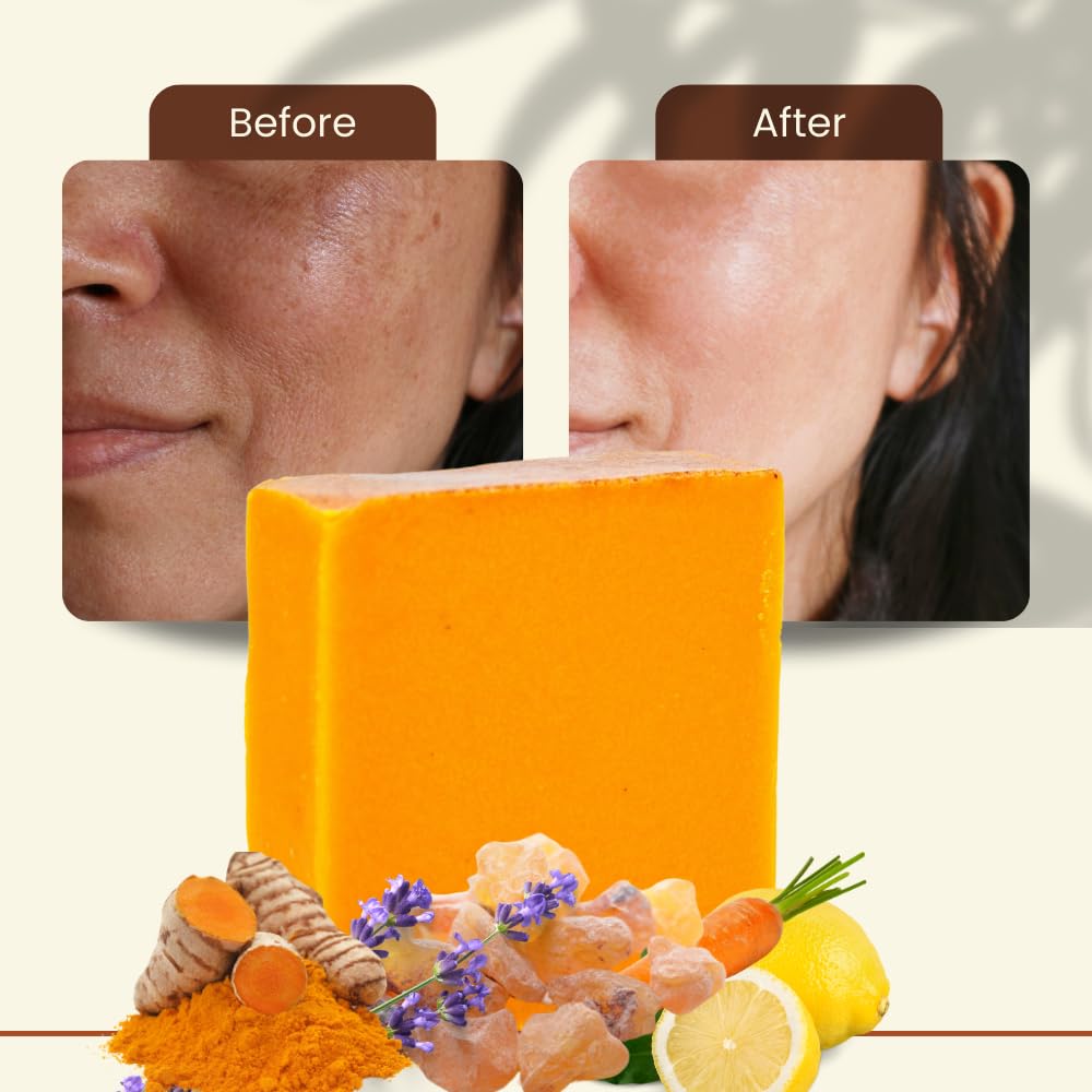 Ammoya Naturals Turmeric Skin Cleansing Soap - Natural Glow Face & Body Cleanser for Acne, Dark Spots & Scars, Gentle for All Skin Types - 2 Bars (4.5 oz)