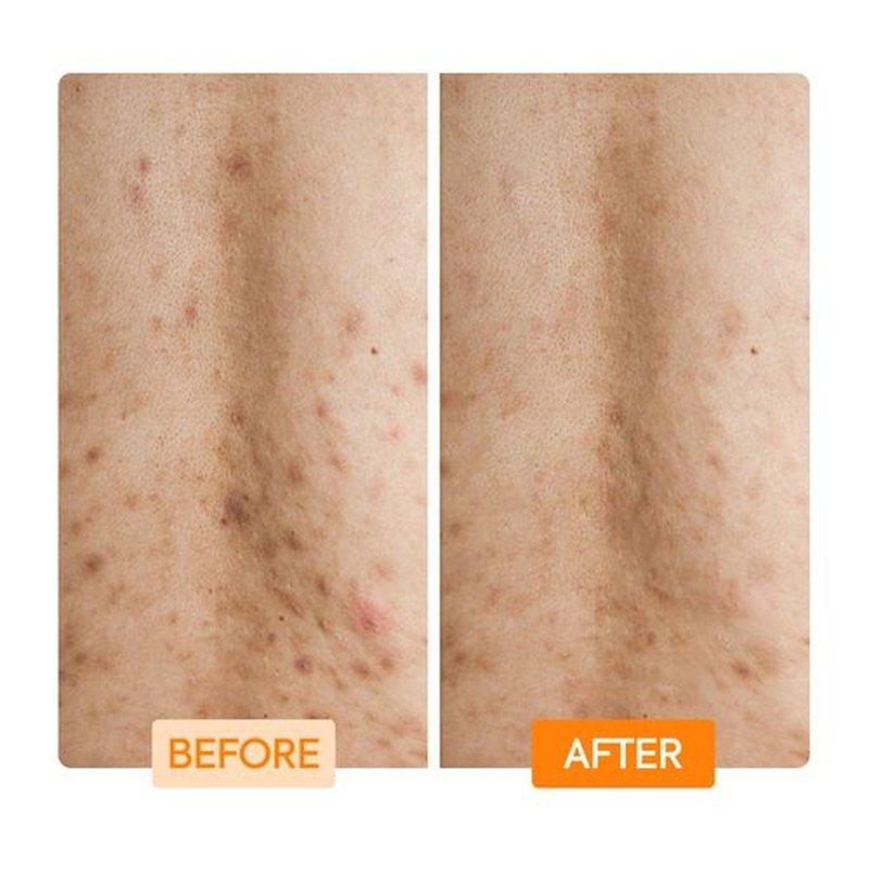 MAKARI IYKYK Gentle Exfoliating Body Wash | Glycolic & Lactic Acid Cleanser with Niacinamide | Smooths Dry Skin for Radiant-Looking Results | Vegan & Fragrance-Free