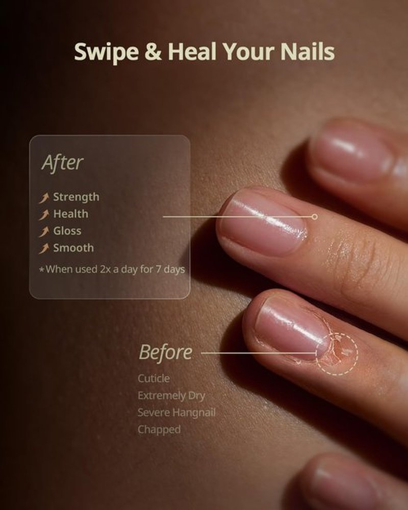 BTARTBOXNAILS Nutri-Forte Cuticle Oil - Deeply Nourishing Formula with Olive Oil & Vitamin E, 15ml