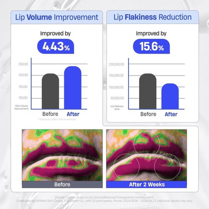 DERMATORY Hyalluron Peptide Lip Mask Balm - Hydrating & Moisturizing Treatment for Day & Night (10ml)