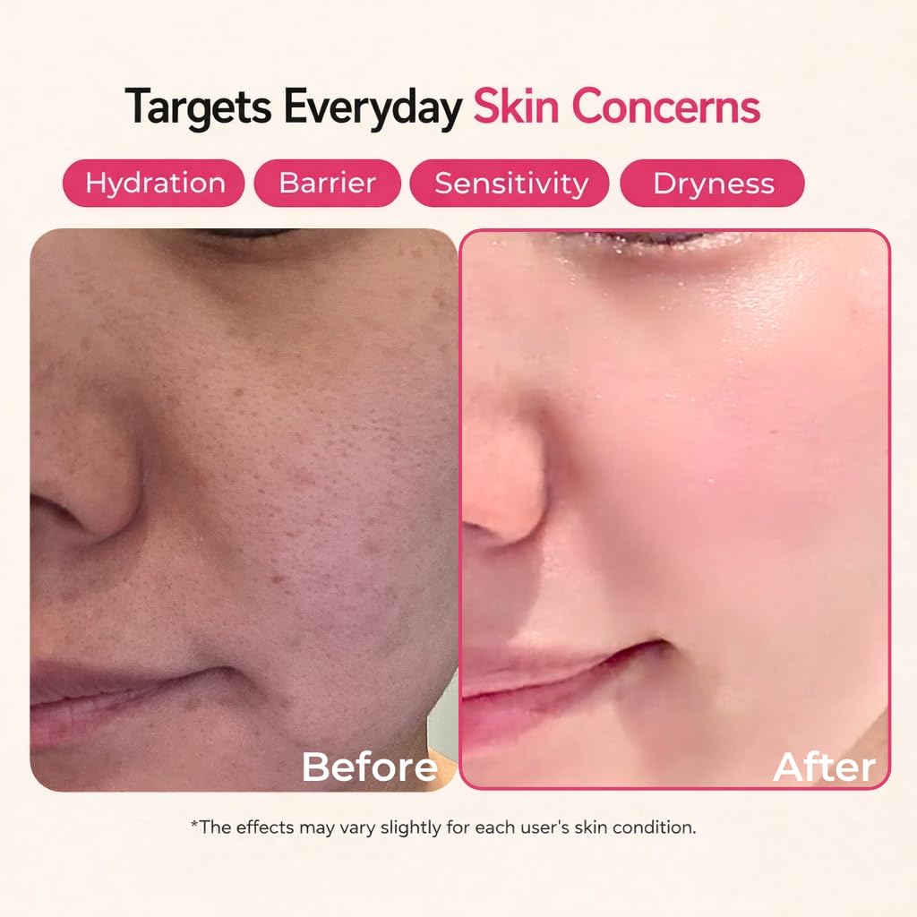 SFROMS Ceramide, Ectoin & Hyaluronic Acid Lotion for Dry & Sensitive Skin, Barrier Repair Moisturizer, Fragrance-Free, Dermatologically Tested, Korean Skincare, 100 ml