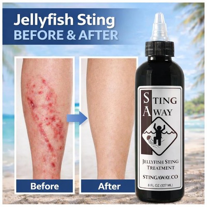 Sting Away - Jellyfish Sting Treatment (8 Ounce)