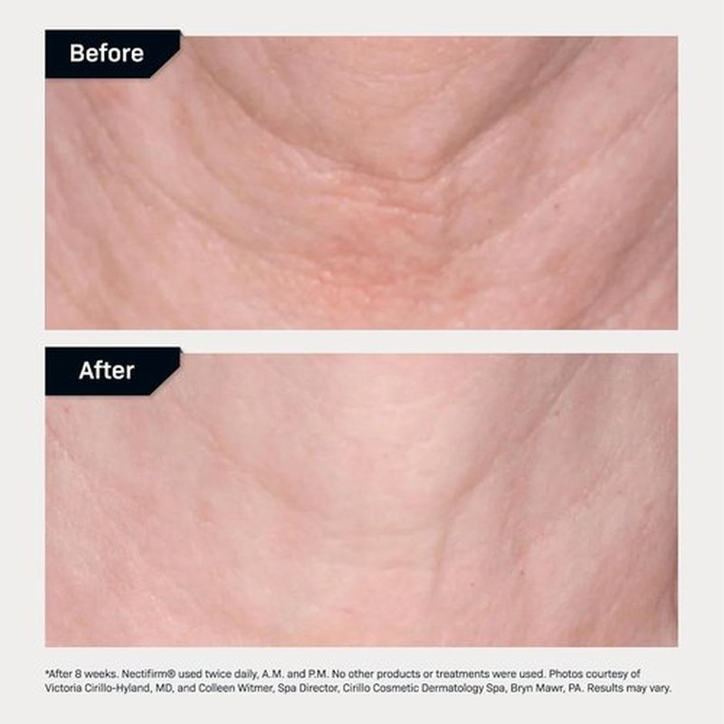 Revision Skincare Nectifirm® Neck Cream - Firm, Lift & Smooth Neck and Jawline | Brightens Skin & Reduces Aging Signs