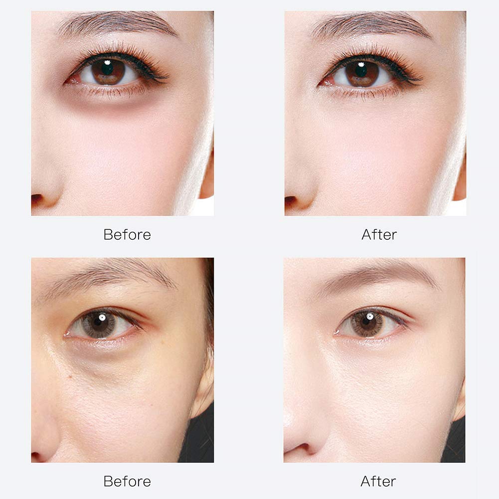 RABIOTA Under Eye Patches,30 pairs Hyaluronic Acid Anti-Aging Under Eye Mask, Collagen Under Eye Gel Pads for Dark Circles, Wrinkles, Fine Line, Puffiness (Blue)