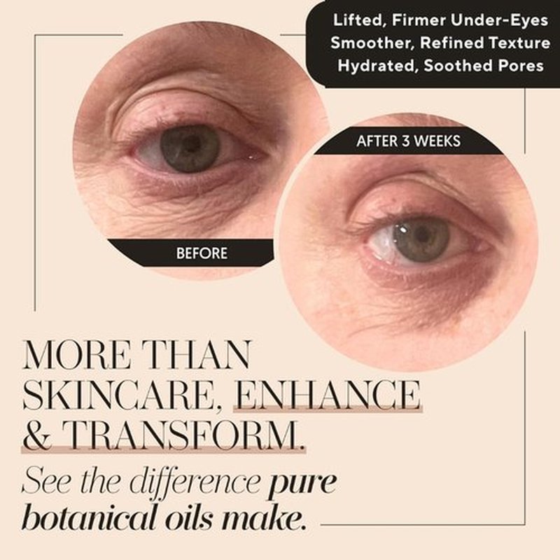 100% Organic Tsubaki Face Oil & Under-Eye Serum. Jojoba, Calendula, & Rice Bran - Hydrating & Brightening for Glowing Skin, Dark Spots & Even Skin Tone, Moisturizing Anti Aging Serum by Finally