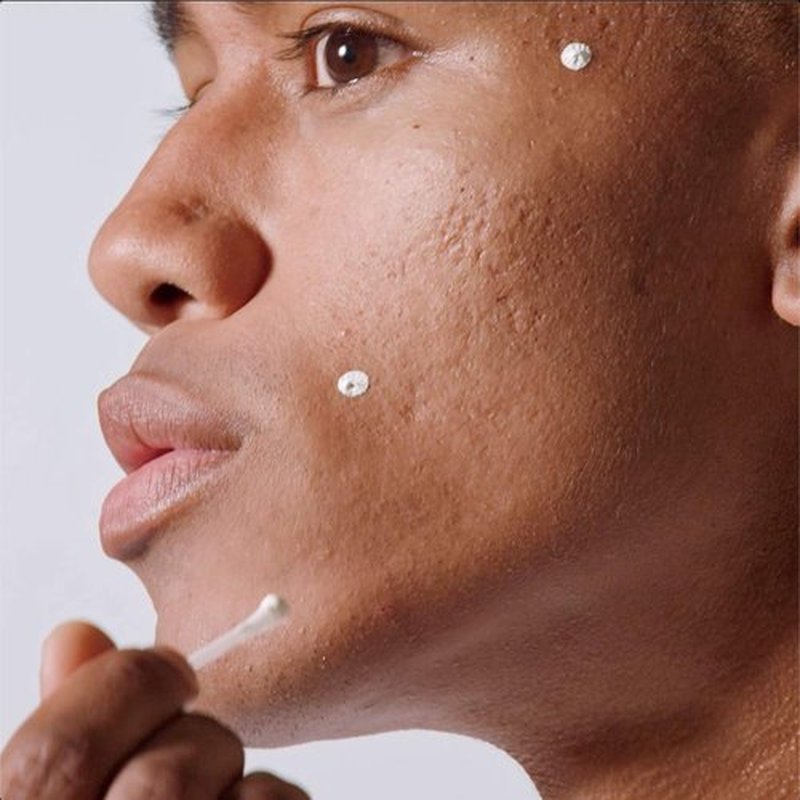 MALIN+GOETZ Acne Treatment - Overnight Spot Treatment with 10% Sulfur & Salicylic Acid | Vegan & Cruelty-Free (0.5 Fl Oz)