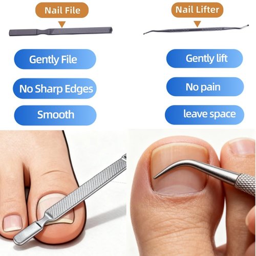 Ingrown Toenail Corrector Set, with Breathable Strips, Painless File & Lifter, Pedicure Tools for Men and Women