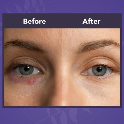NOVEHA Lavender and Tea Tree Oil Eyelid Foaming Cleanser | Hydrating Hypoallergenic Daily Soap For Eyelashes and Lids, For Demodex, MGD, Stye Eye, Eye Irritations & Dry Skin | 3.38 fl oz (3PK - 100ml)