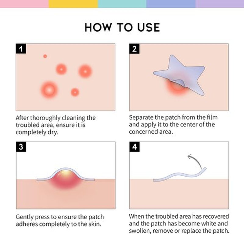 #OOTD Star Pimple Patches – Hydrocolloid Acne & Spot Patch for Face, Cute Pastel Colors, Niacinamide & Ceramide, K-Beauty Skincare – Stocking Stuffer for Teen Girls – 80 Count