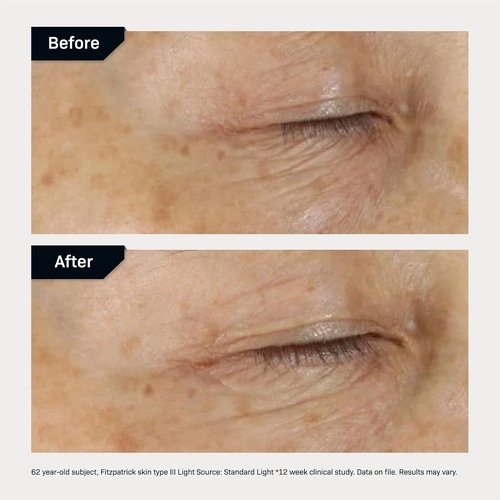 Revision Skincare D·E·J Eye Cream® - Firming & Moisturizing Treatment for Fine Lines & Wrinkles