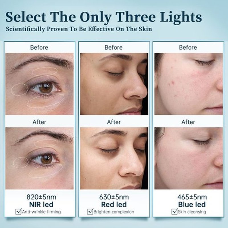 GYH LED Face Mask - Wireless Red & Blue Light Therapy for Anti-Aging | FSAHSA Eligible, Cloud-S (RB-014)