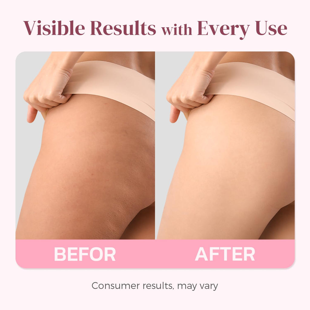 Solivetta Butt Tight Lift and Firm Booty Cellulite Cream - Smooth & Sculpt Booty, Thighs, Belly & Arms | LIFTONIN® Skin Firming & Toning Bum Mask 3.72 fl oz