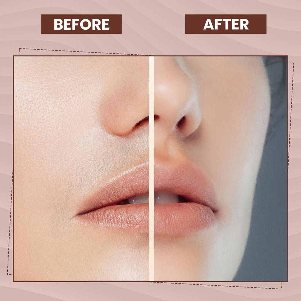 Facial Hair Remover for Women – Electric Face Razor with Light, Hair Removal for Upper Lip, Chin & Cheeks – Color Rose Gold