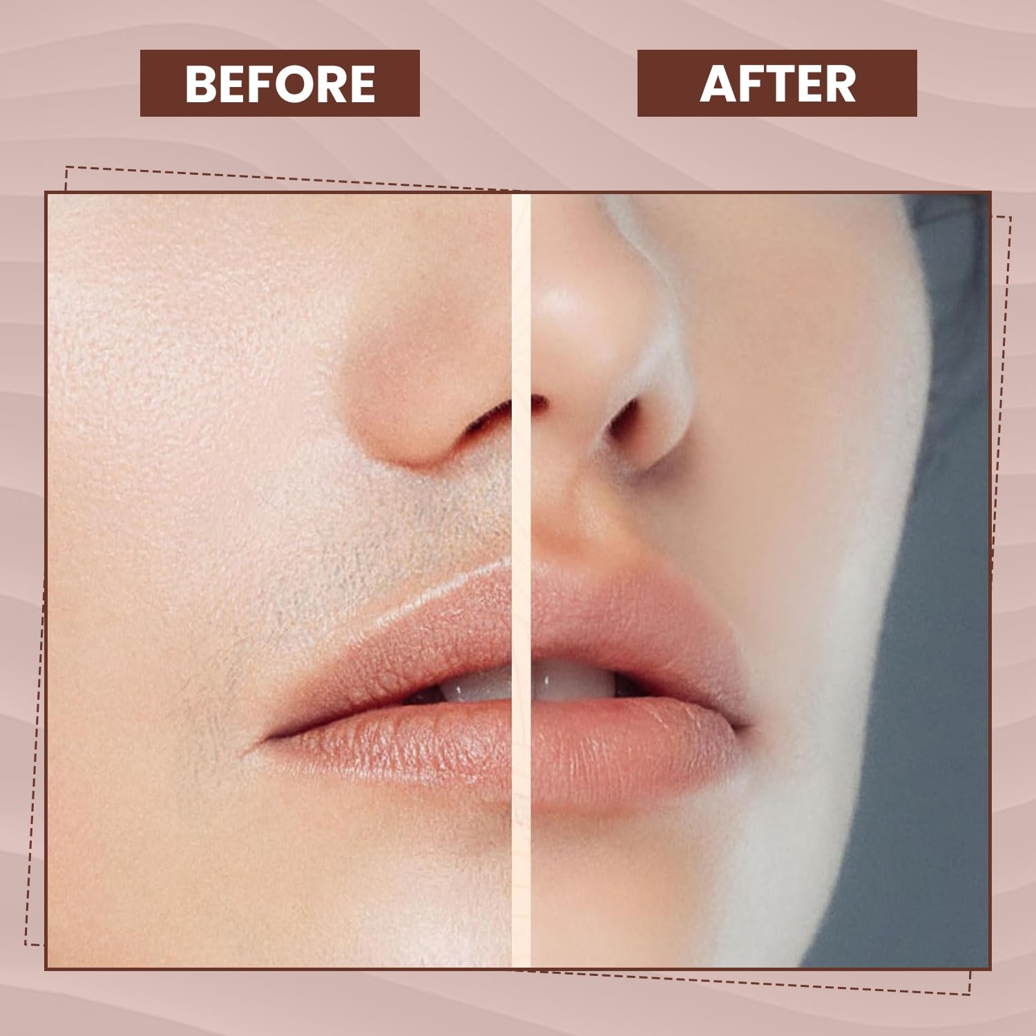 Facial Hair Remover for Women – Electric Face Razor with Light, Hair Removal for Upper Lip, Chin & Cheeks – Color Rose Gold