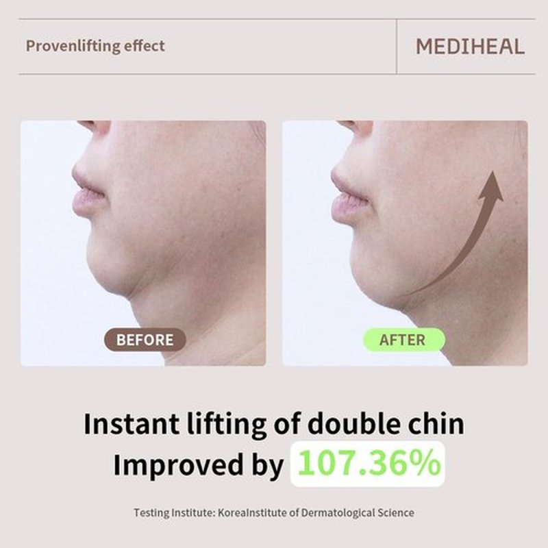 Mediheal Retinol Collagen Cream Lifting Mask | Anti-Aging V-Line Treatment (10 Counts) - Reduces Fine Lines & Wrinkles