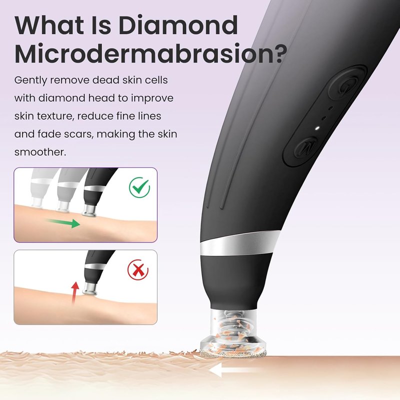 UNOISETION Diamond Microdermabrasion Machine - Rechargeable Facial Tool with 12 Tips | Blackhead Remover for Home & Travel
