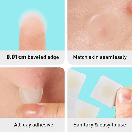 TKTK Pimple Patches, 12mm Invisible Acne Patches for Face with Salicylic Acid, 0.01cm Extra Thin Outer Edge, Hydrocolloid Zit Patch for Pustule, Whitehead, Cystic Acne Spot, 96 Count