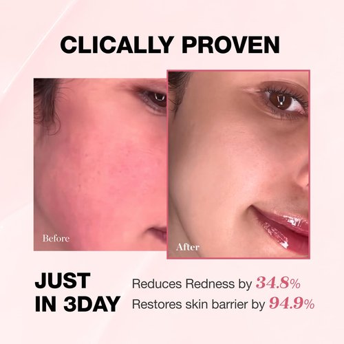 Physiogel Redness Reducing Cream – Ceramide Moisturizer for Dry, Sensitive & Redness-Prone Skin, Repairs Skin Barrier, Dermatologist-Tested, Fragrance-Free, Korean Skincare, 1.69 fl oz
