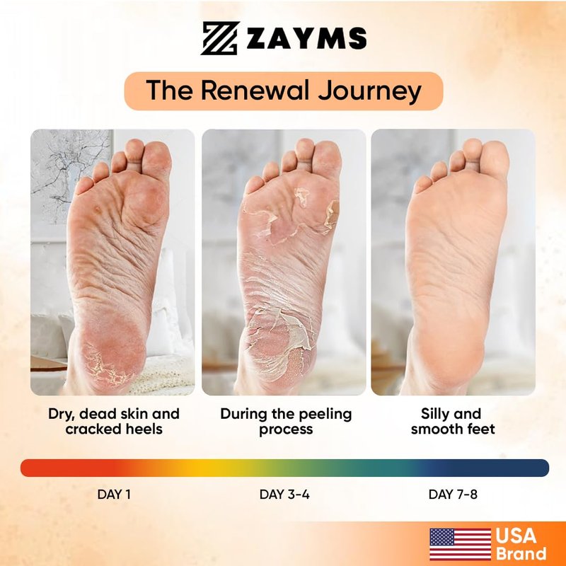 ZAYMS Foot Peeling Mask 5 Pack - Exfoliating Mask for Baby Soft Feet, Removes Dead Skin & Calluses, Repairs Cracked Heels, Natural Peel for Smooth, Soft Feet