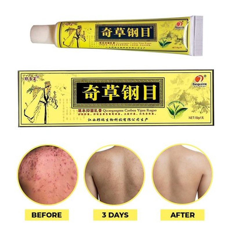 QICAOGANGMU Official Seller - Chinese Herbal Cream - Natural Relief for Skin Issues - Pack of 5