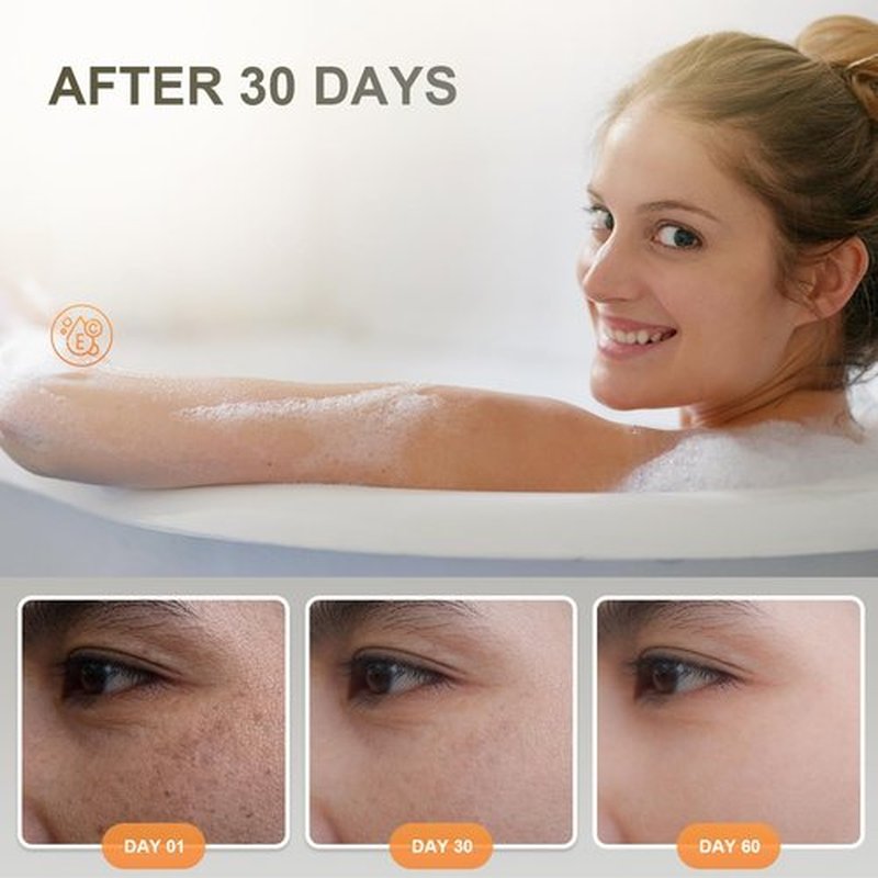 Premium Turmeric Kojic Acid Soap Bar – Hydrating & Nourishing Serum for Face & Body – Exfoliating Cleansing Bar with Vitamin C, Retinol & Collagen – Kojic Acid & Turmeric Cleansing Pads Alternative