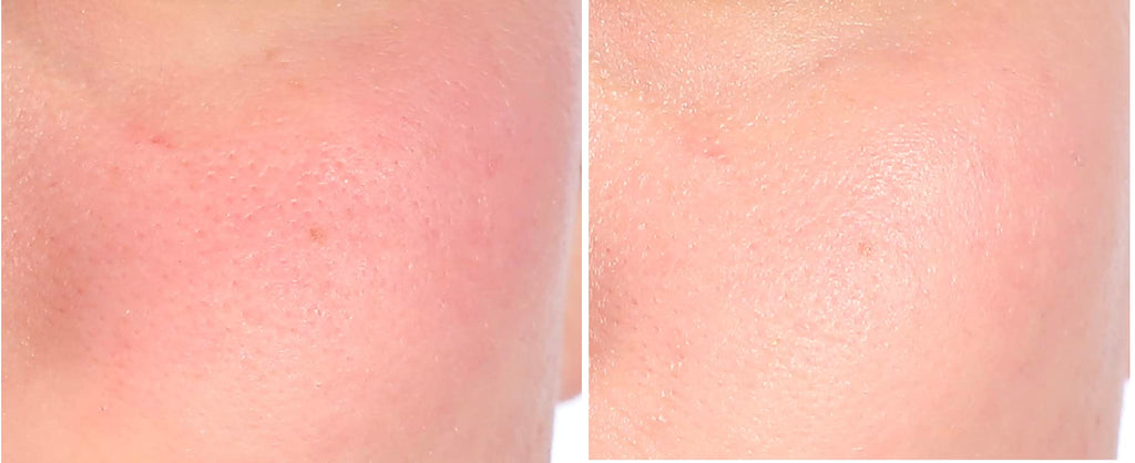 Nakery Intensive Repair Treatment Eczema Relief Soothing Cream for Face & Body | 2% Colloidal Oatmeal | Immediate Relief