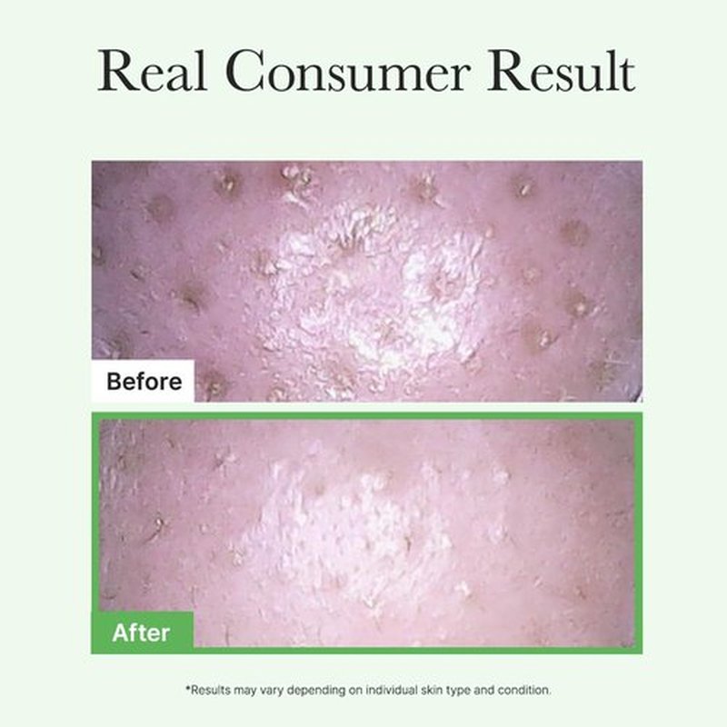 ARENCIA Pore Melt Mochi Makeup-Removing Cleansing Oil, Non-Comedogenic, Rice Amino Acids HD, Vitamin E, Cica, & Ceramide, 6.76 fl oz