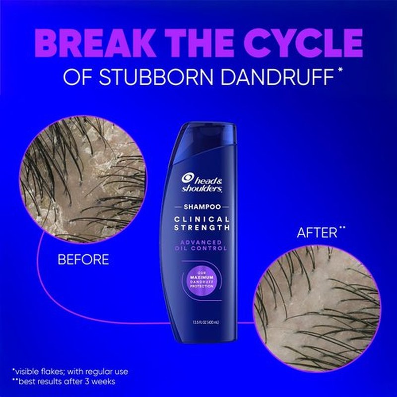 Head & Shoulders Dandruff Shampoo, Clinical Strength Advanced Oil Control, Our Maximum Anti-Dandruff Prescription-Strength Formula, Flake Protection, Seborrheic Dermatitis Relief, Citrus, 13.5 Fl Oz