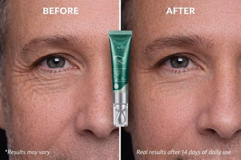 Skiennix Anti-Wrinkle Face Cream - Rejuvenating Peptide Moisturizer with 5 Peptides & Vitamins | 15ml