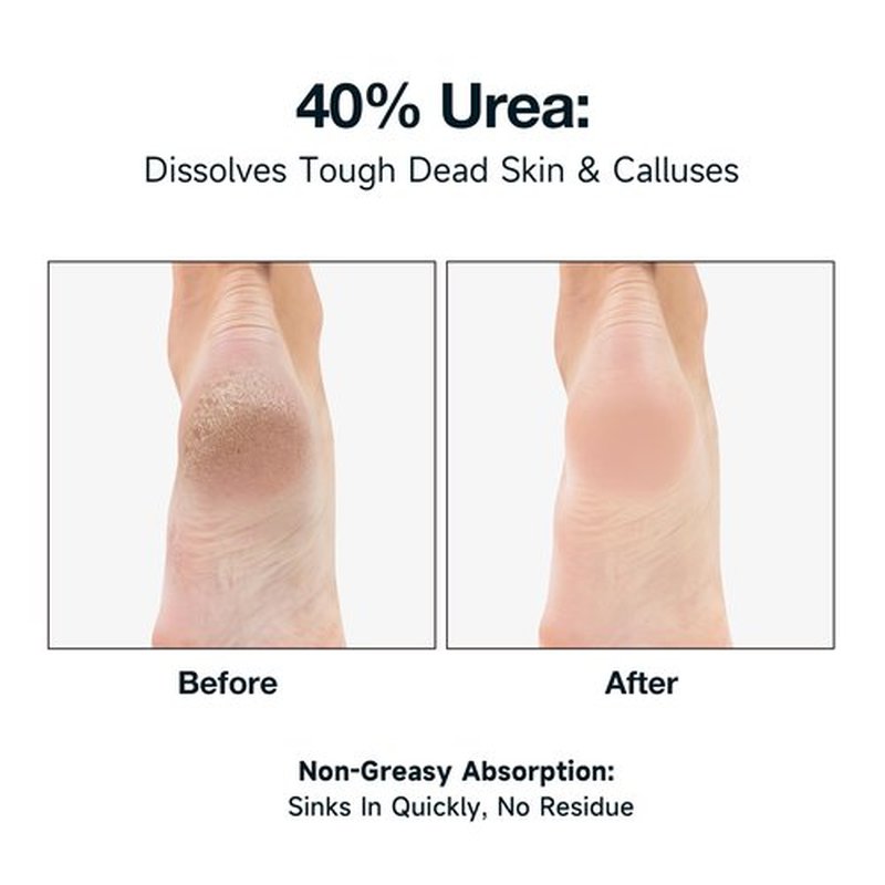 NOVAL Urea Foot Cream 40% with 2% Salicylic Acid, 8.8 OZ Value Size for Dry Cracked Heels, Calluses, Feet, Hands, Elbows & Knees
