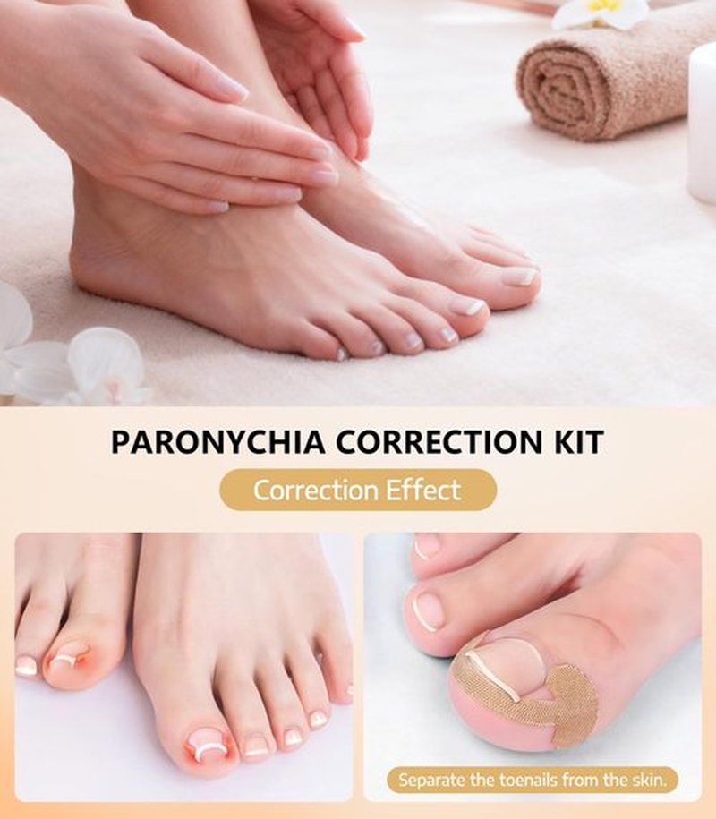Ingrown Toenail Corrector Set with 50 Positive Nail Strips & 20 Breathable Patches, Professional Pedicure Tool Kit for Curved Toenails, Easy to Use for Beginners