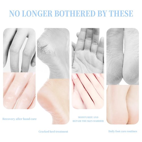 BTYJLEBE Crack Feet Prevention Stick Strength Moisturizer Foot Lotion Stick for Cracked Heels Refreshing Hydrates Callus Skin Softene for Dry Cracked Feet Knees Elbows Hands (2pcs blue ＆ peach)