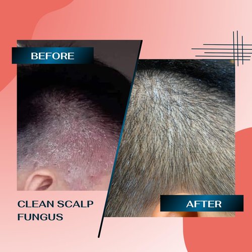 DEGO HERBAL Deep Refresh Zizyphus Scalp Care Shampoo – Gentle Cleanse for Healthy-Looking Hair 2.7 Fl Oz. Natural extract from tree bark