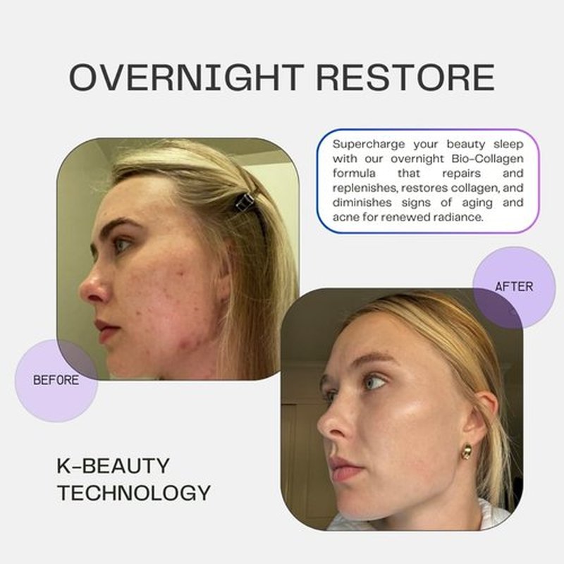 SkinFusion Bio-Collagen Sheet Face Masks (Overnight Restore, 5 Pack) with Retinol + Ceramides - Anti-Aging, Minimize Wrinkles and Pores, Deep Hydration, Firming - Gifts for Women - K Beauty