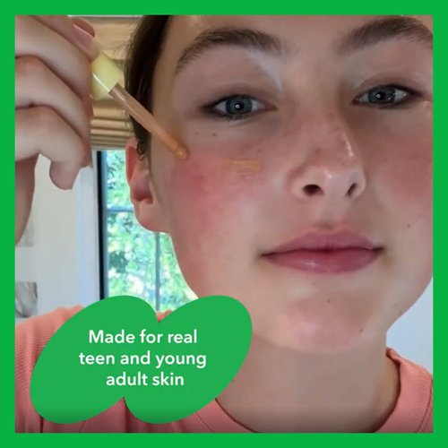 Skiennix Facial Moisturizer - Nourishing Face Lotion with MCT Oil & Cucumber | 1.7 fl oz for Tween & Teen Skin