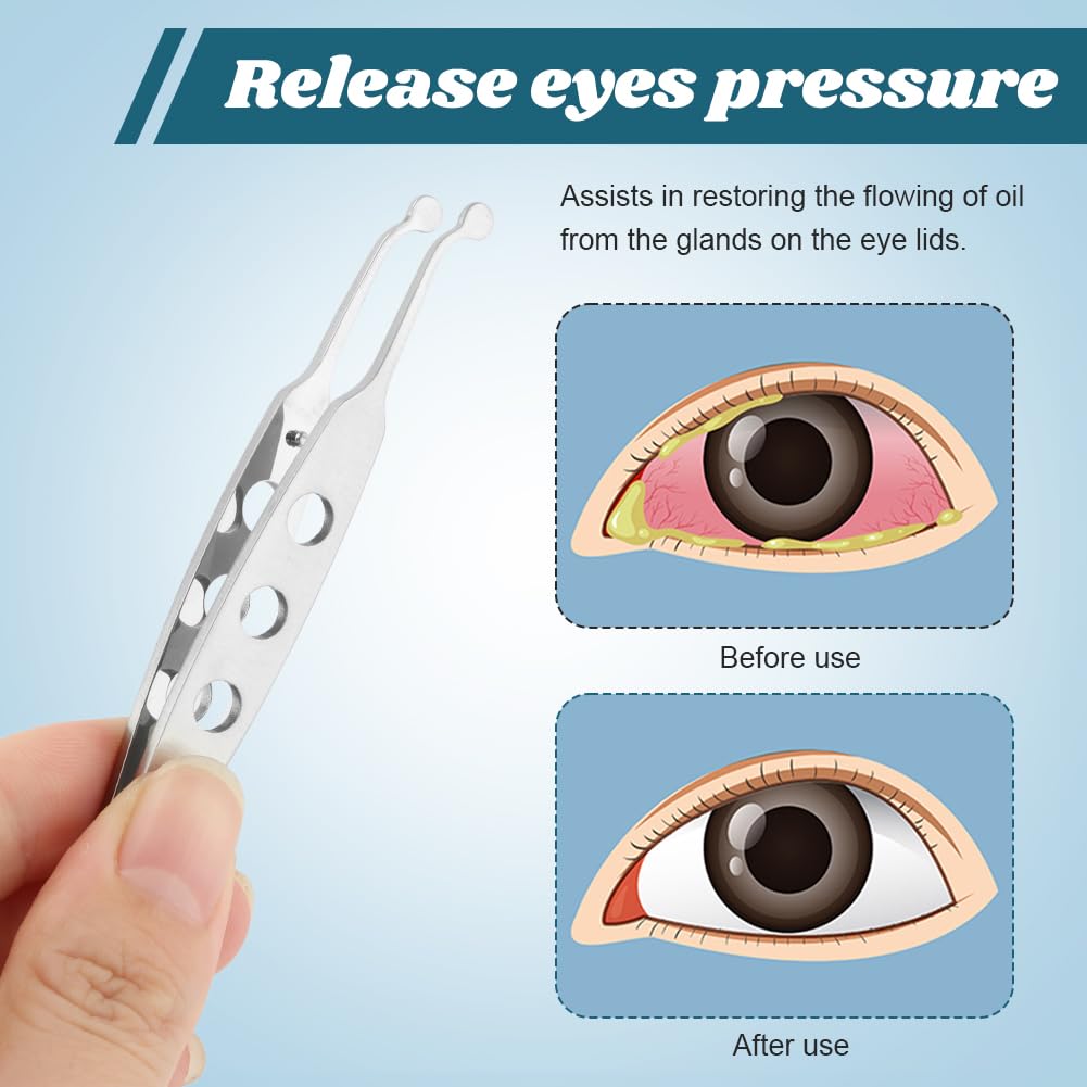 Meibomian Gland Expressor, Stainless Steel Eyelid Massage Tweezer with Positioning Pin, Eyelid Gland Blockage Unblocking Physiotherapy Tools, Eyeli-d Expressor for Dry Eyes(SIZE:3x3mm/0.12x0.12inch)